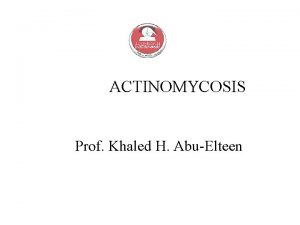 ACTINOMYCOSIS Prof Khaled H AbuElteen ACTINOMYCETES In this