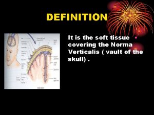 DEFINITION It is the soft tissue covering the