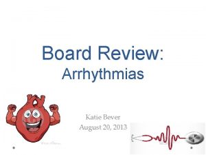 Board Review Arrhythmias Katie Bever August 20 2013