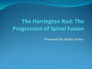 Harrington spine