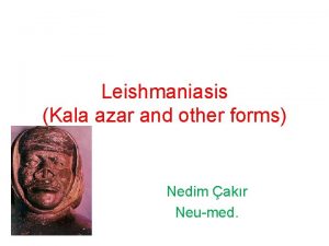 Leishmaniasis Kala azar and other forms Nedim akr