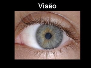 Miopia usa lente divergente ou convergente