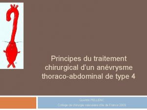 Principes du traitement chirurgical dun anvrysme thoracoabdominal de