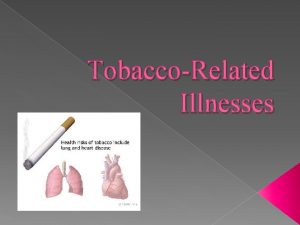 TobaccoRelated Illnesses Anatomy of the Lungs EMPHYSEMA Emphysema