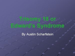 What is edwards syndrome