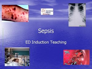 Sepsis ED Induction Teaching What is Sepsis ACCPSCCM