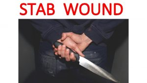 Wedge shaped stab wound