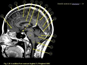 Coronal section ct