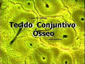 Tecido Conjuntivo sseo Tecido Conjuntivo Funes Dar sustentao