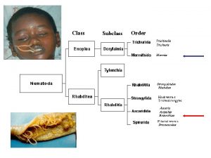 Ascaris lumbricoides is one of the largest and