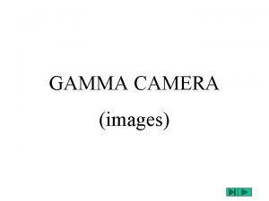 Gamma camera images Gamma camera images