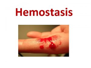 Hemostasis Objectives 1 What is Hemostasis 2 Steps