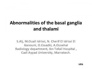 Abnormalities of the basal ganglia and thalami S