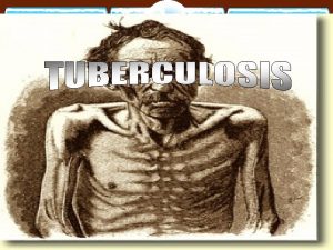 Pulmonary TB BY PROF AZZA ELMedany Dr Ishfaq