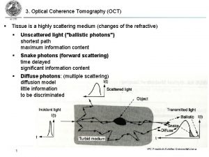 3 Optical Coherence Tomography OCT Tissue is a