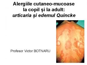 Chronic inducible urticaria