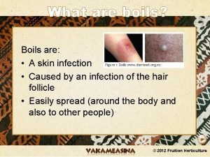 What are boils Boils are A skin infection