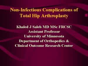 NonInfectious Complications of Total Hip Arthroplasty Khaled J