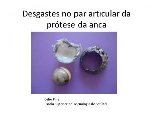 Desgastes no par articular da prtese da anca