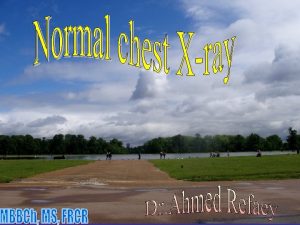 How do you look at chest x ray