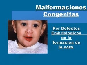 Malformaciones Congenitas Por Defectos Embriologicos en la formacion