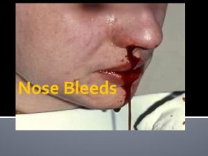 Nose Bleeds Can be caused from numerous things