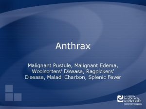 Anthrax Malignant Pustule Malignant Edema Woolsorters Disease Ragpickers