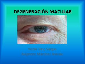 DEGENERACIN MACULAR Victor Dato Vargas Alejandro Martnez Arvalo