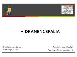 Hidranencefalia