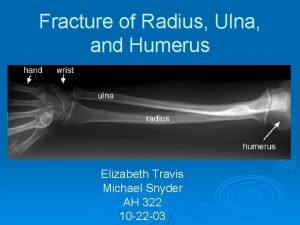 Fracture of Radius Ulna and Humerus Elizabeth Travis