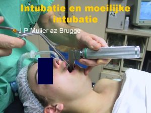 Moeilijke intubatie
