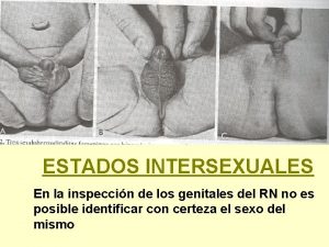 Intersexual fotos