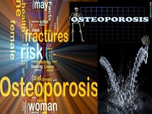 ASUHAN KEPERAWATAN OSTEOPOROSIS SUHRON Pengertian Definisi Osteoporosis berasal