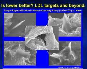 Is lower better LDL targets and beyond Implications