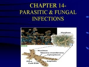CHAPTER 14 PARASITIC FUNGAL INFECTIONS WHY IS THIS