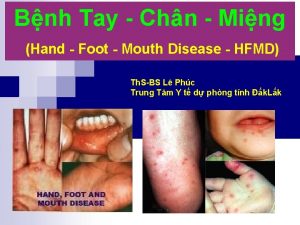 Bnh Tay Chn Ming Hand Foot Mouth Disease
