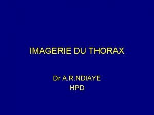 Index cardio thoracique