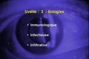 Uvite 3 itiologies Immunologique Infectieuse Infiltrative Uvite 3
