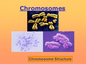 Chromosomes Chromosome Structure Prokaryotic chromosome The term prokaryote