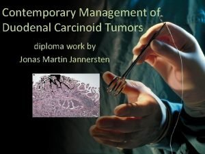 Contemporary Management of Duodenal Carcinoid Tumors diploma work