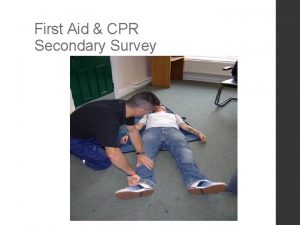 Surveyhead