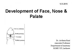 12 5 2015 Development of Face Nose Palate