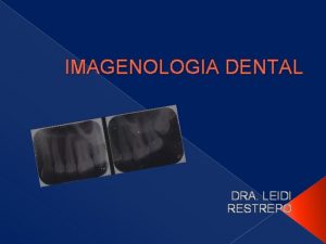 IMAGENOLOGIA DENTAL DRA LEIDI RESTREPO DEFINICIN Es un