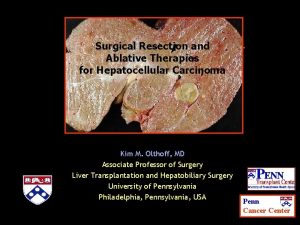 Surgical Resection and Ablative Therapies for Hepatocellular Carcinoma