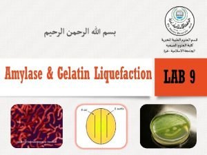 Gelatin hydrolysis test