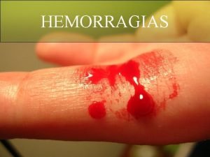 HEMORRAGIAS Se entiende por hemorragia a la salida