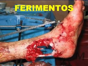 FERIMENTOS FERIMENTOS CONCEITO Ferimento uma leso tecidual causada