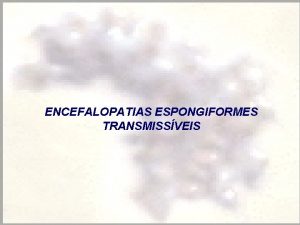 ENCEFALOPATIAS ESPONGIFORMES TRANSMISSVEIS ENCEFALOPATIAS ESPONGIFORMES TRANSMISSVEIS 1 Conceito