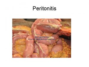 Peritonitis Peritonitis Intraabdominal infections Two major clinical manifestations