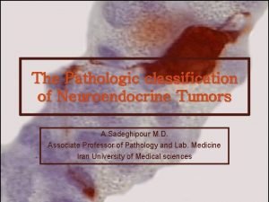 The Pathologic classification of Neuroendocrine Tumors A Sadeghipour